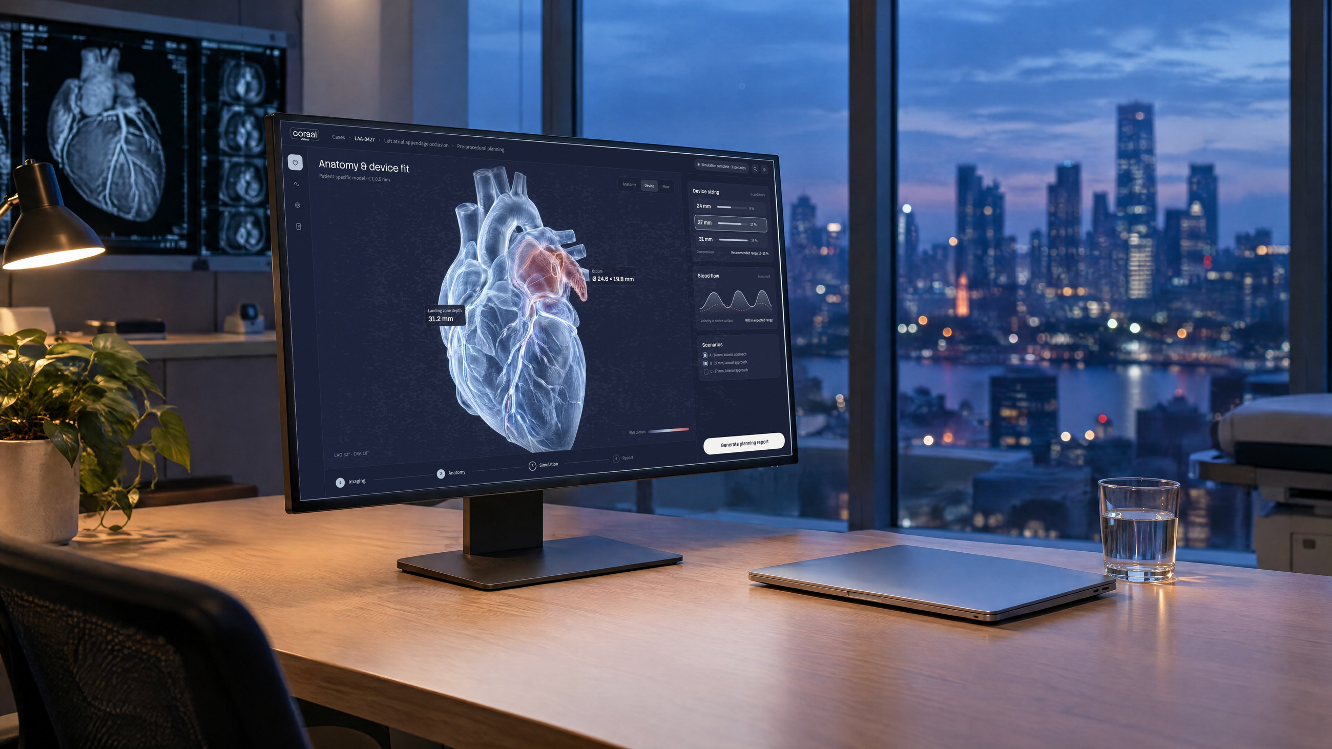Recreación: Coraal, el software de planificación de Virtest, en una sala de un hospital a la hora azul